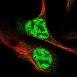 RAD54L Antibody, Novus Biologicals 0.1mL; Unlabeled:Antibodies, Polyclonal